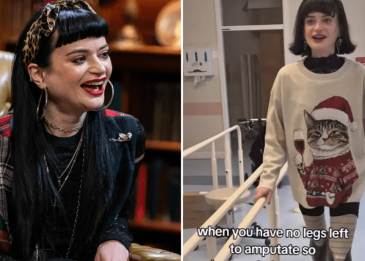 Celebrity Traitors star, 29, walks again after undergoing second leg amputation